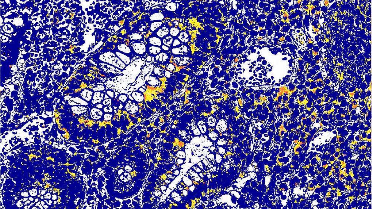 A close-up microscopy image showing scattered circular cell-like structures against a dark blue background, evoking biological or gut microbiome imagery. Used as a navigational thumbnail for the Biologics and Advanced Therapies FAQ section.