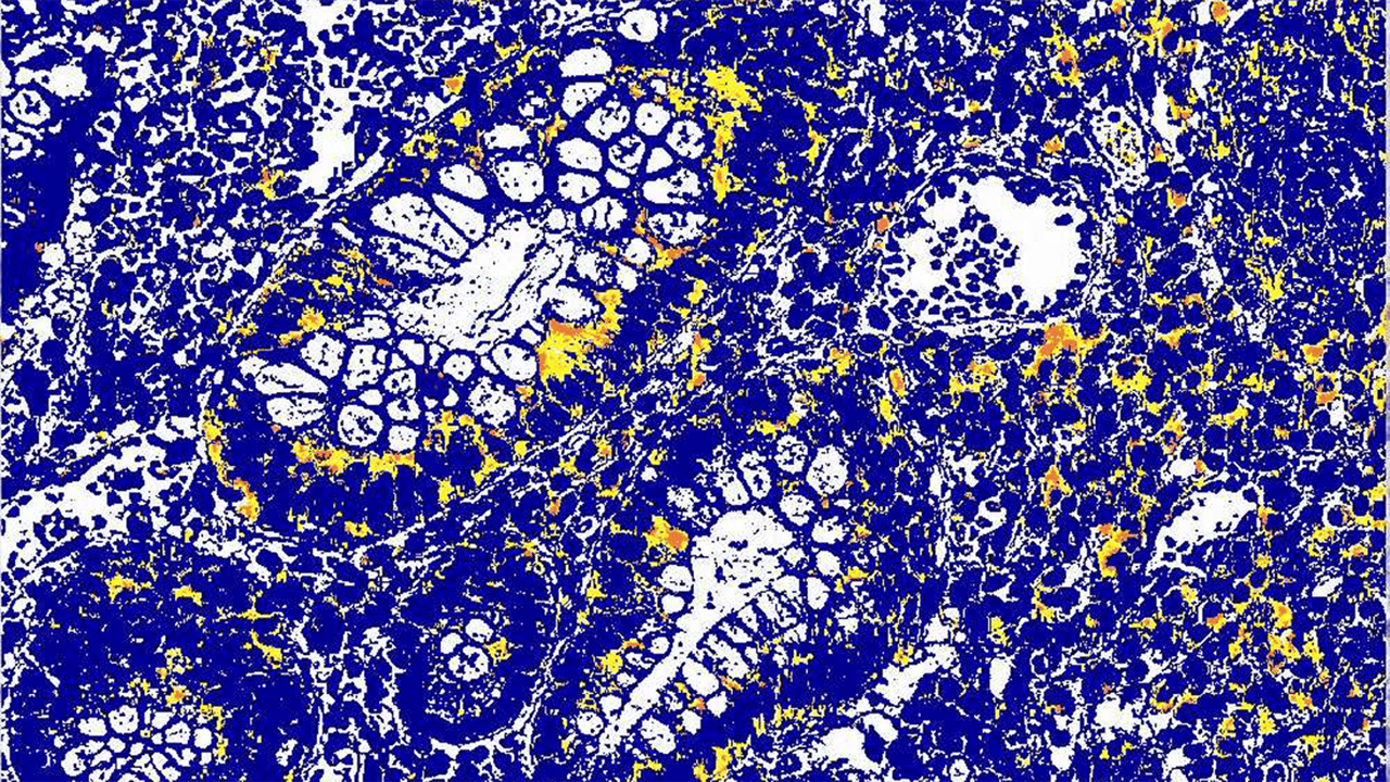 A close-up microscopy image showing scattered circular cell-like structures against a dark blue background, evoking biological or gut microbiome imagery. Used as a navigational thumbnail for the Biologics and Advanced Therapies FAQ section.