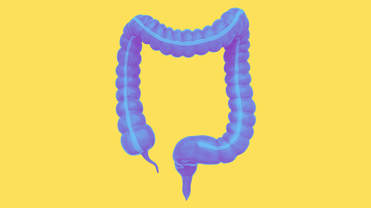 What is ulcerative colitis?