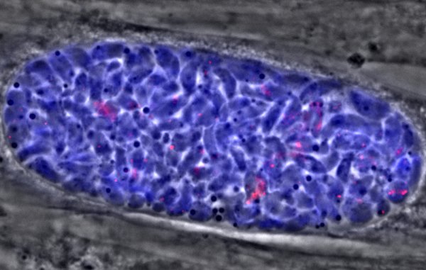 Research aims to starve toxoplasma