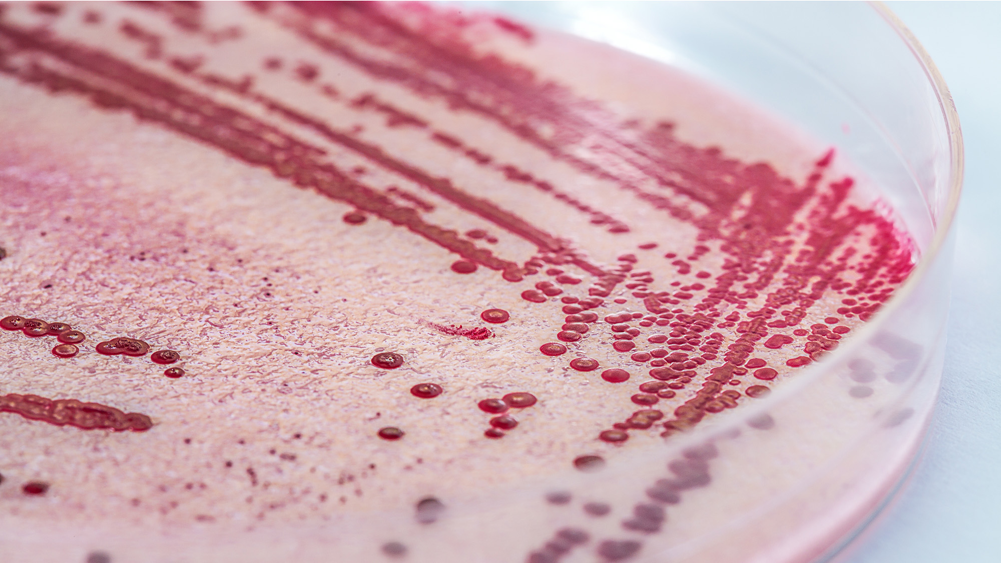 FSIS 2027 sampling plan expands listeria testing in RTE plants