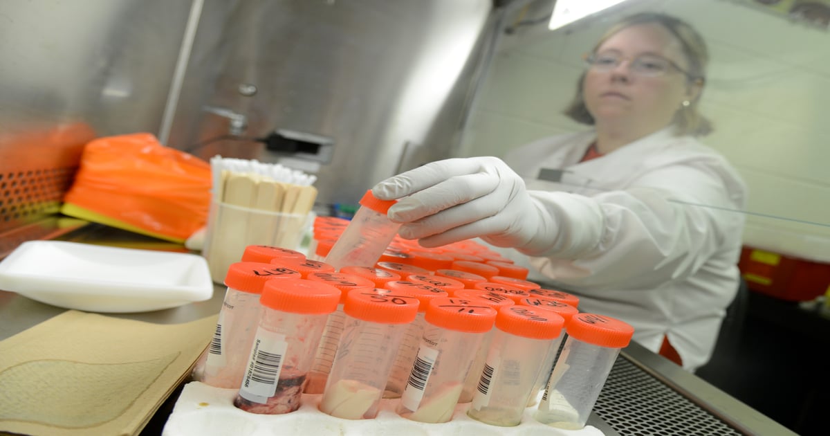 Diagnostic lab helps identify, track anthrax outbreak
