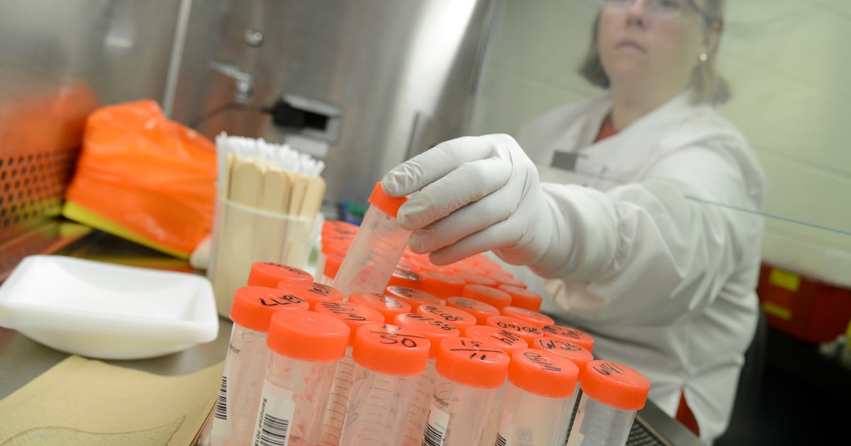 Anthrax Lab Testing Diagnostic lab helps identify, track anthrax outbreak