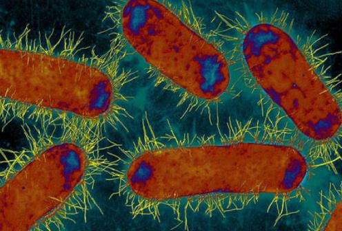 Making resistant superbugs sensitive to antibiotics again