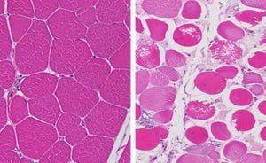 UDel wooden breast syndrome cells.jpg