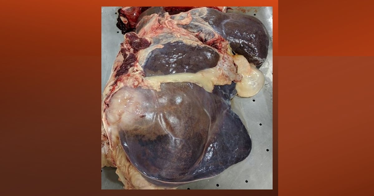 Liver abscesses have hidden costs for cattle producers