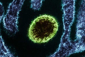 Pirbright Nipah virus.jpg