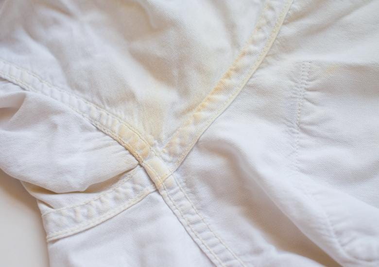 Deodorant stains on a dress shirt