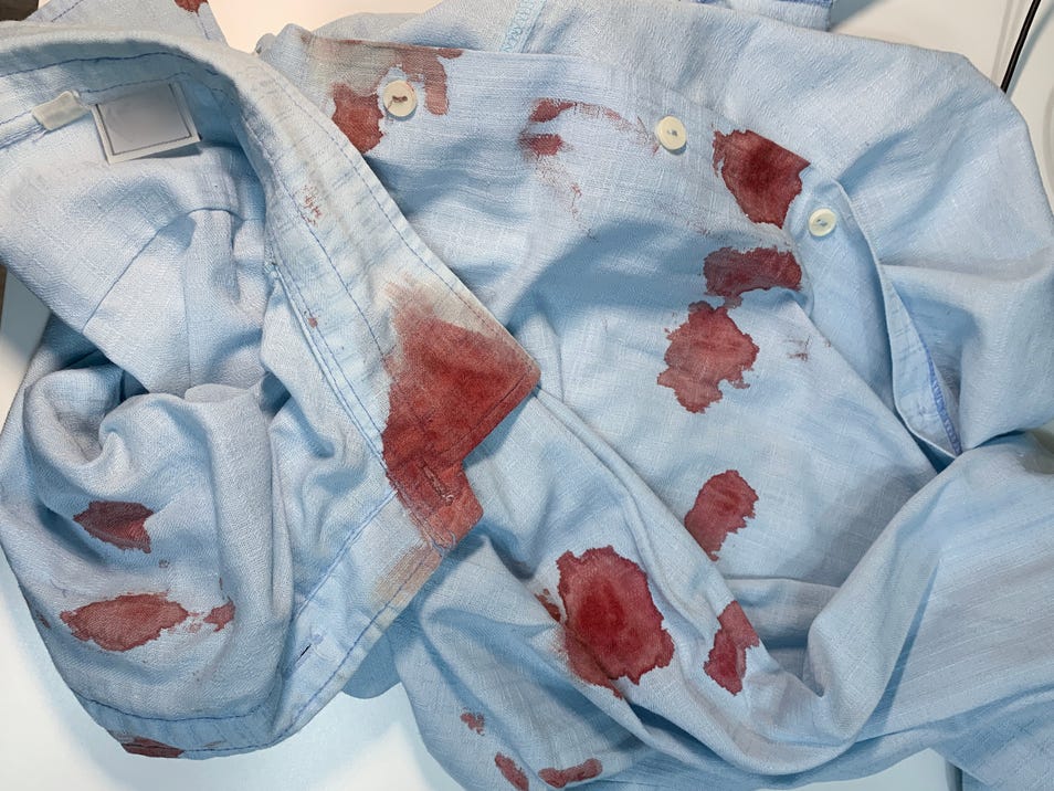 Cleaning protein-based stains from fabrics