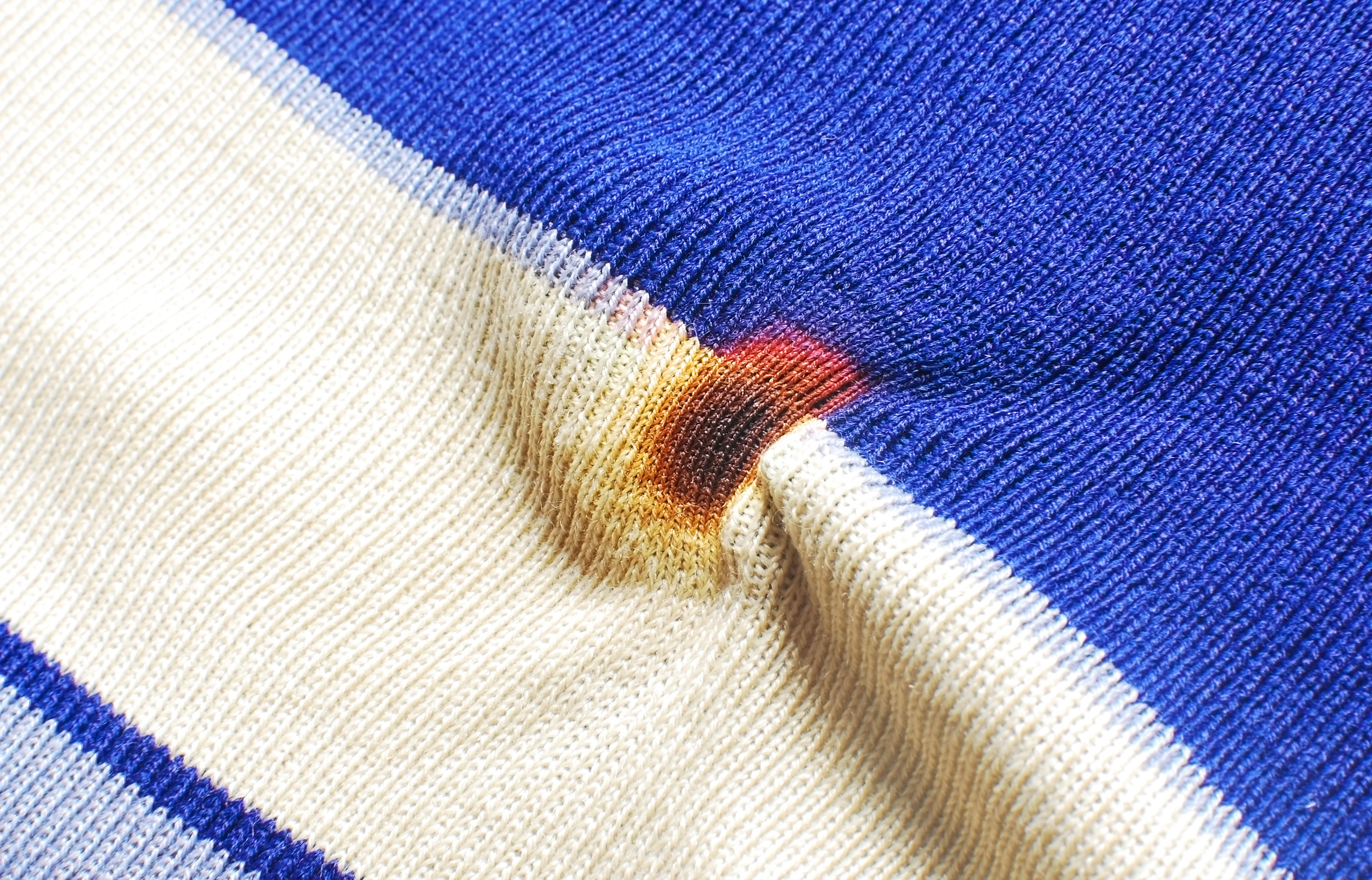 washing burn stain with vanish