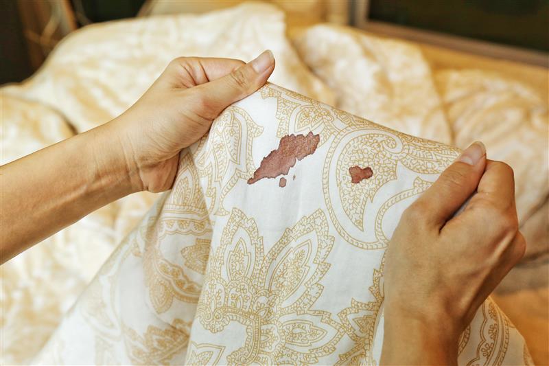 How to remove blood stain on bed sheet