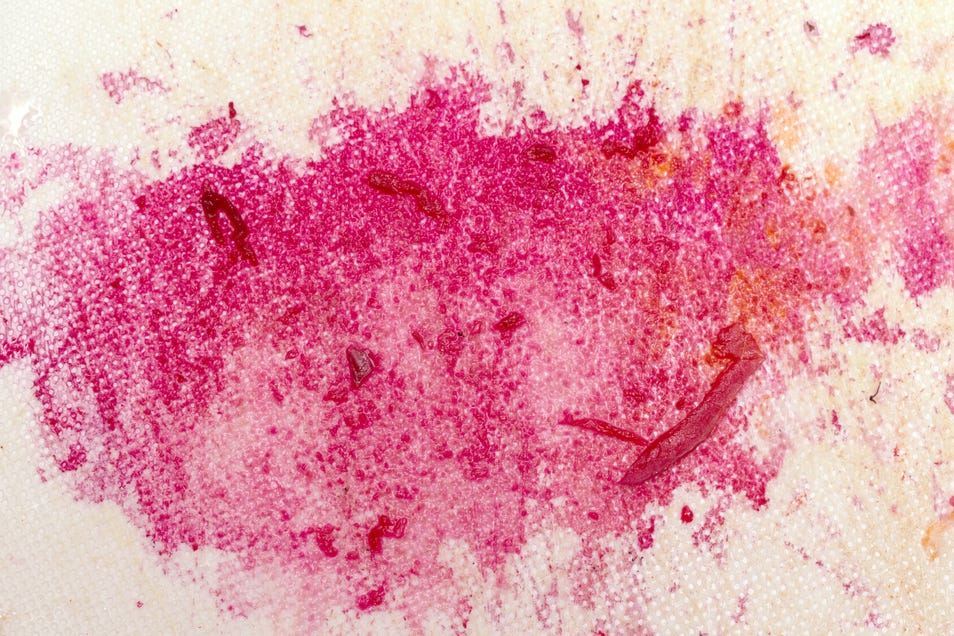 remove beetroot stains from clothes