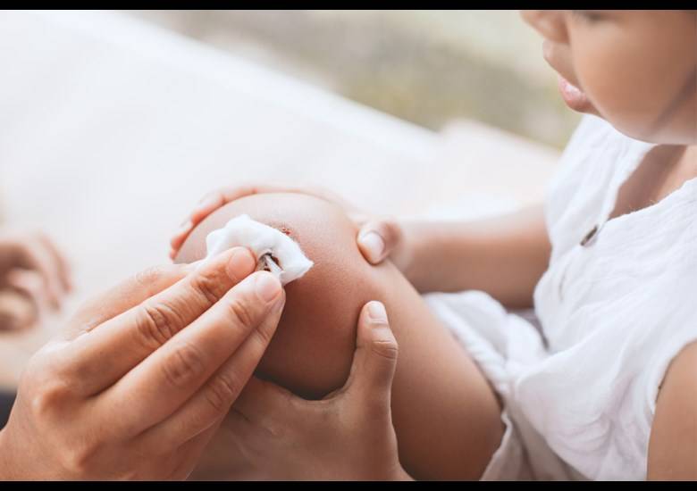 Mano de mujer con gasa curando raspón en rodilla a niña