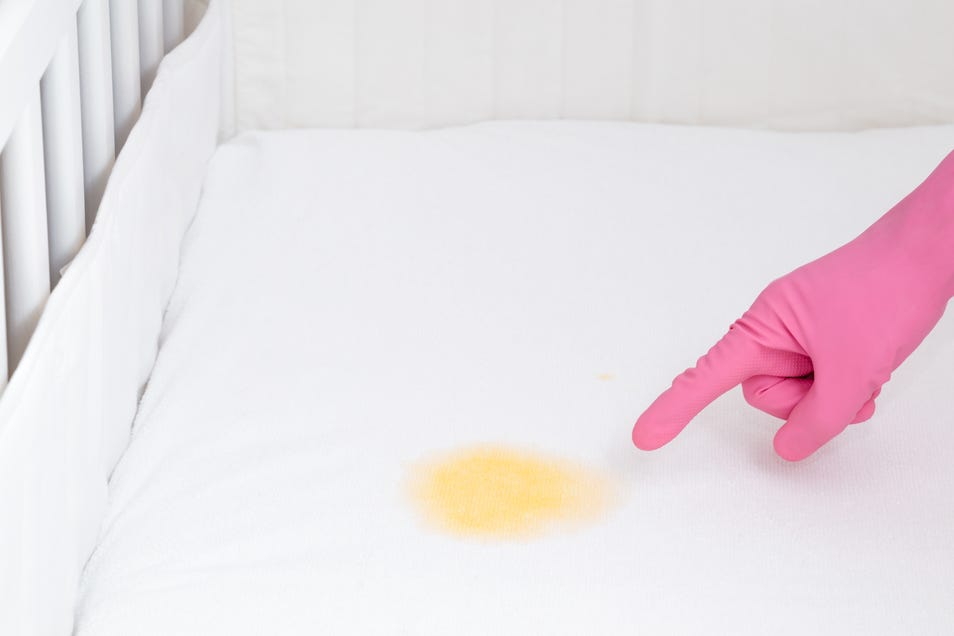 wash turmeric stains from bedsheet