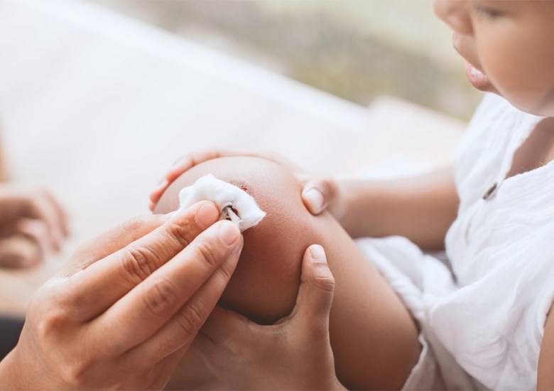 Como remover nódoas de sangue