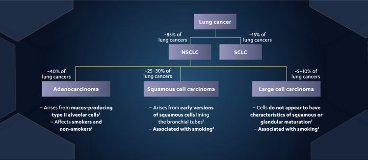 Subtypes of lung cancer