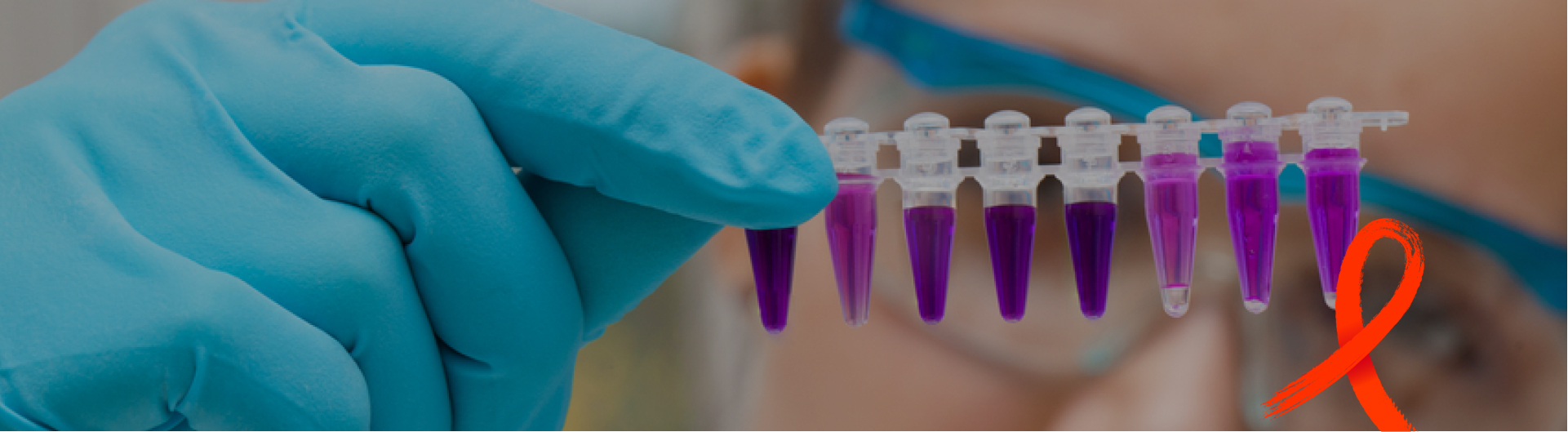 Симптомы ВИЧ | Первые признаки заболевания