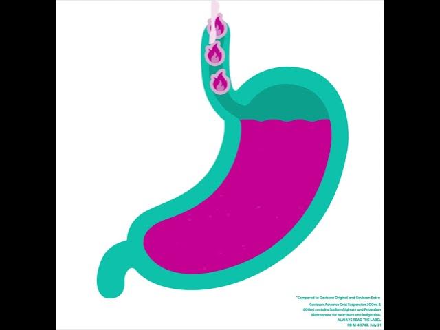 How Gaviscon Advance works