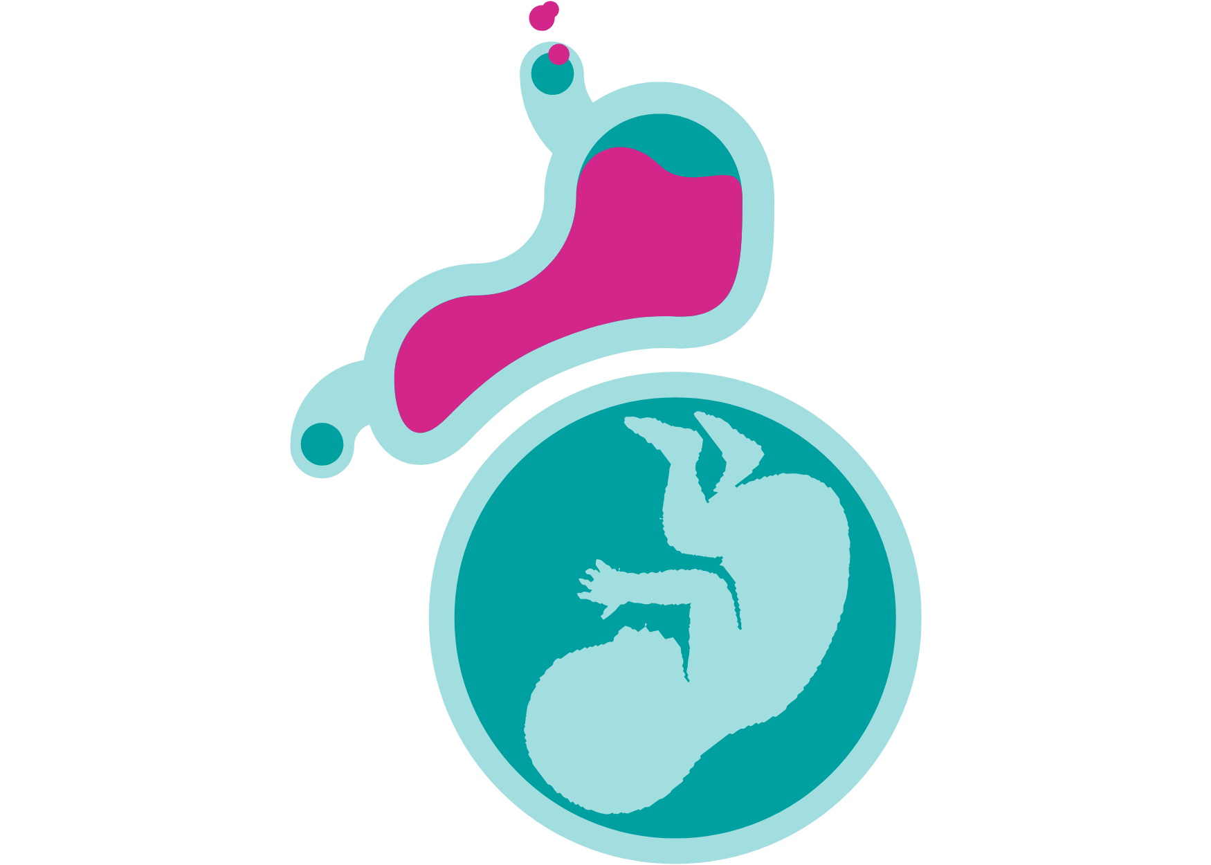 Heartburn during pregnancy