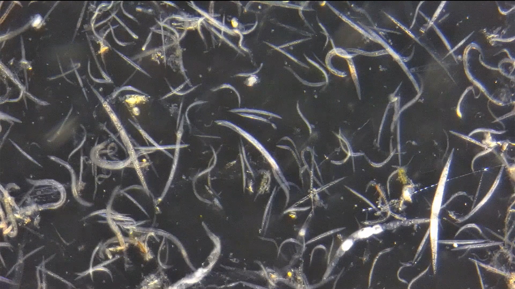 Nematodes under a microscope