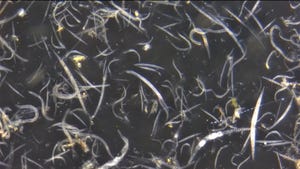 Nematodes under a microscope Nematodes under a microscope